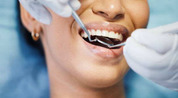 Best Emergency Dentist for Lost Fillings or Crowns in Laporte, CO